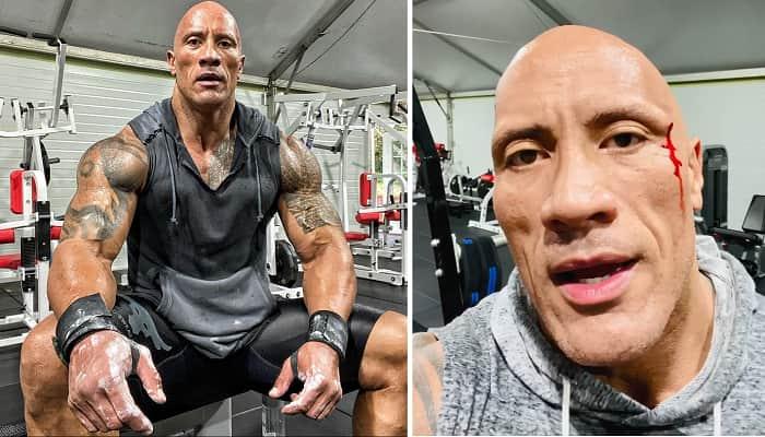 Dwayne 'The Rock' Johnson Suffers Injury on Set of A24's 'The Smashing Machine'.